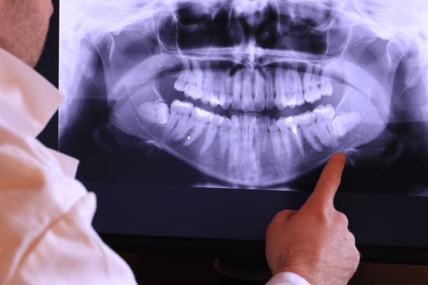 Best Knocked-Out Tooth Emergency  in Revere, MA