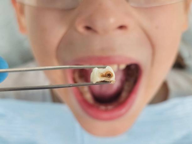 Best Tooth Infection Emergency Dentist  in Revere, MA